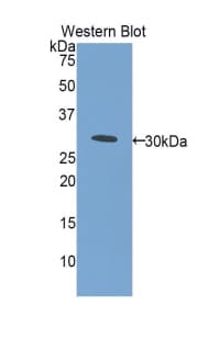 ETFA Antibody (aa52-295, Cy3)