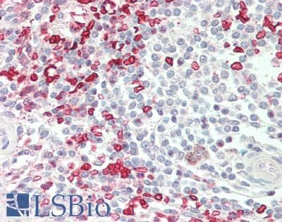 IHC-plus™ HMBS / PBGD Antibody