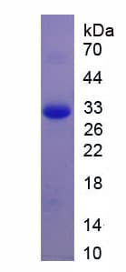 Human BDNF Protein (Recombinant His, N-Terminal)