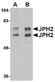 IHC-plus™ Junctophilin 2 / JPH2 Antibody