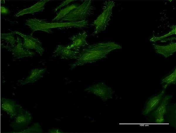 IFNGR2 Antibody (clone 2D9)