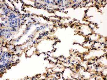 S100A6 / Calcyclin Antibody