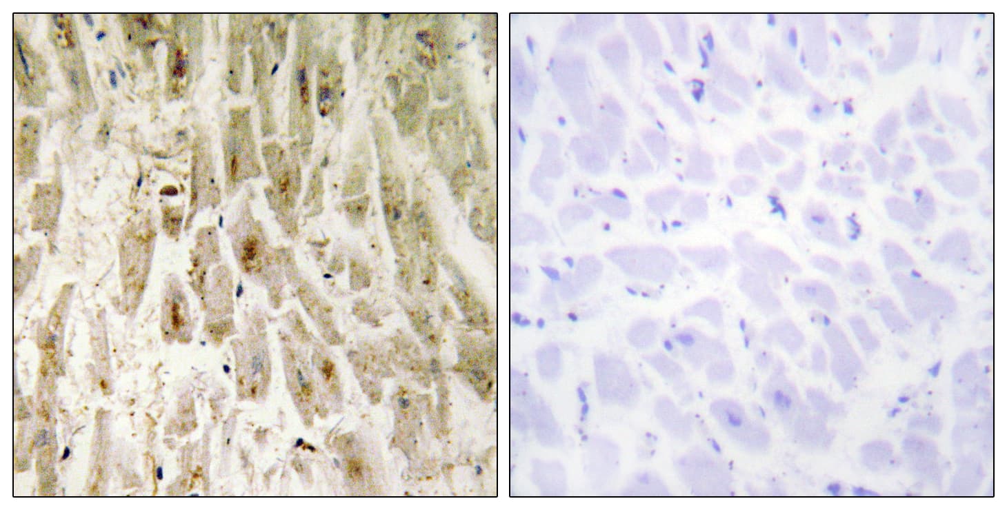 Polyclonal Rabbit anti-Human SMAD1 Antibody (aa416-465, IHC, WB)