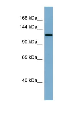 KL / Klotho Antibody (aa467-516)