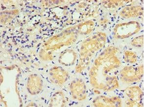 LBC / AKAP13 Antibody (aa1-150)