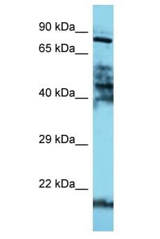 DAXX Antibody (aa608-657)