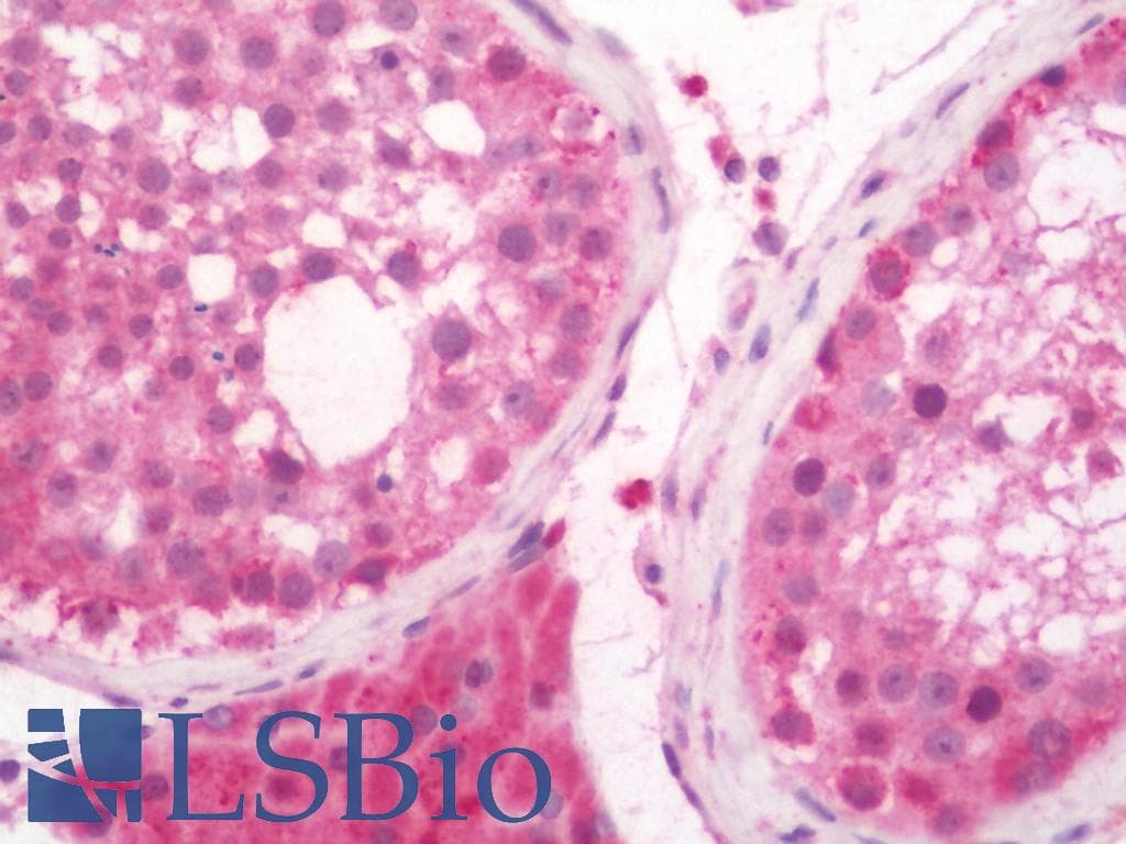 IHC-plus™ MAP1S Antibody