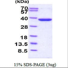 Human TS / Thymidylate Synthase Protein (Recombinant His)