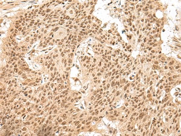 Polyclonal Rabbit anti-Human GMEB2 Antibody (IHC)