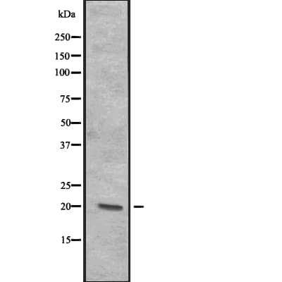 ITGB3BP Antibody