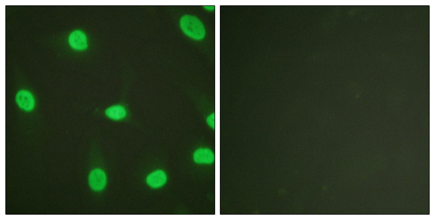 XRCC5 / Ku80 Antibody (p714)