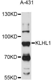 Polyclonal Rabbit anti-Human KLHL1 Antibody (WB)