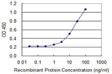 IHC-plus™ Monoclonal Mouse anti-Human SLC9A3R1 / NHERF1 / EBP50 Antibody (clone 2B7, IHC, WB)