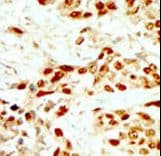 DAPK2 / DAP Kinase 2 Antibody (aa40-70)