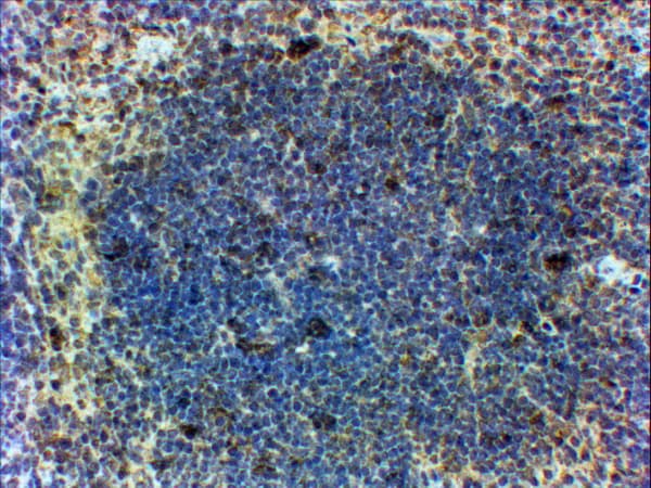 Polyclonal Goat anti-Mouse FOXP3 Antibody (aa416-427, IHC)