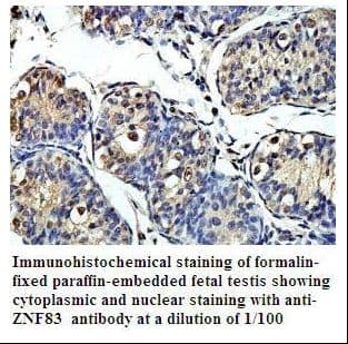 ZNF83 / HPF1 Antibody (aa56-332)