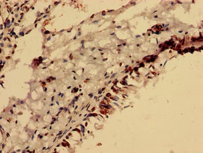 Polyclonal Rabbit anti-Human FOXR2 Antibody (IHC, WB)