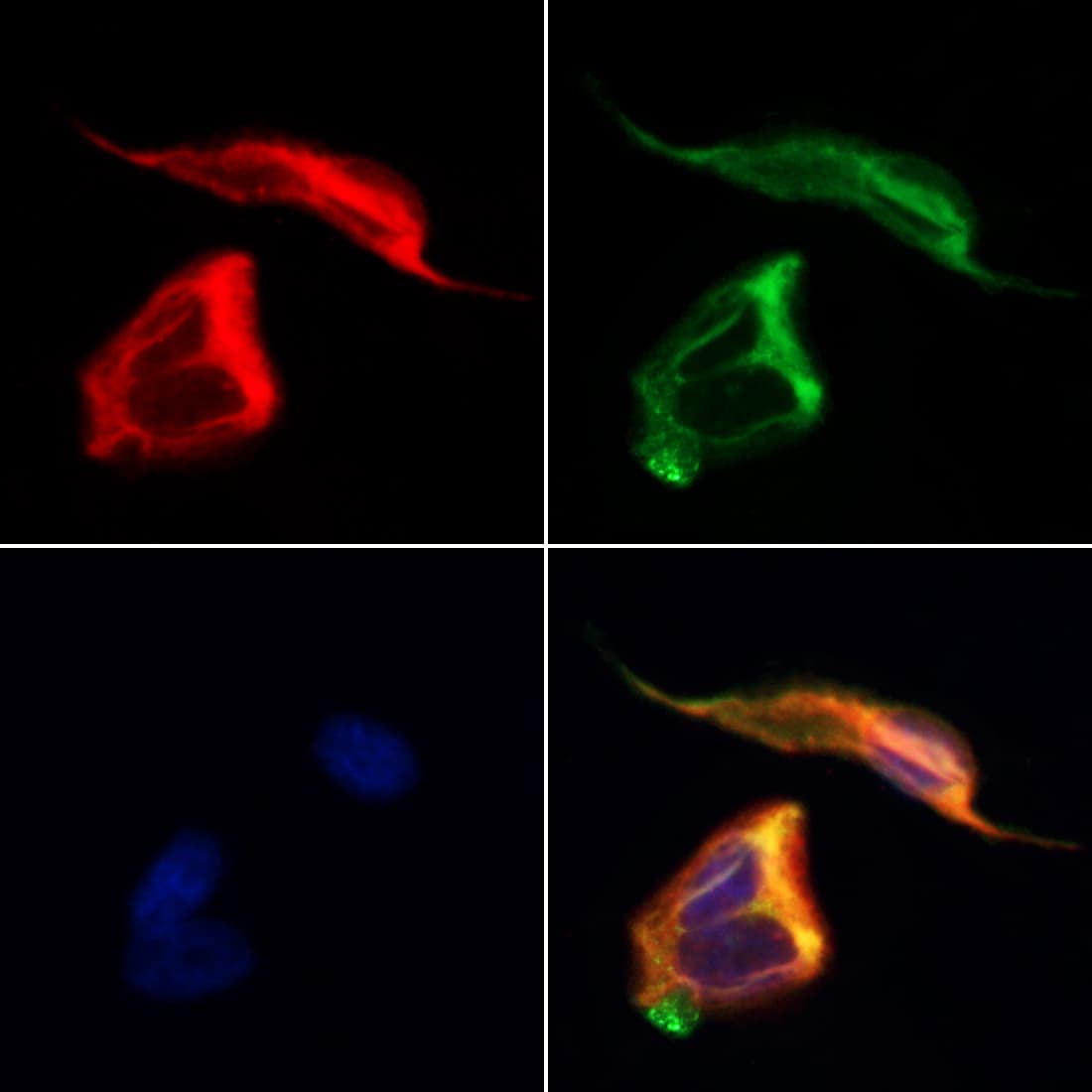 Polyclonal Rabbit anti-Human DPYSL5 / CRMP5 Antibody (IF, WB)