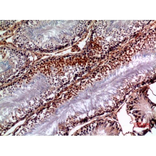 Polyclonal Rabbit anti-Human PNPLA6 / NTE Antibody (1031-1080 aa, Internal, IHC, WB)