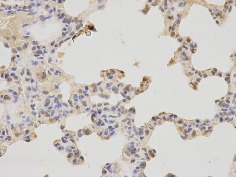 Polyclonal Rabbit anti-Human PAX3 Antibody (IHC, IF, WB)
