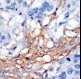 Polyclonal Rabbit anti-Human PIP5K1C Antibody (aa637-668, IHC, WB)