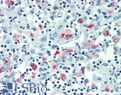 MARCO Antibody (aa366-518)