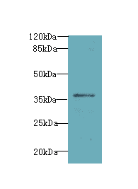 ASB7 Antibody