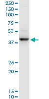 RNF2 / RING2 / RING1B Antibody (clone 3G6)