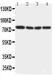 IRAK1 / IRAK Antibody (aa18-37)