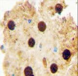 Polyclonal Rabbit anti-Human OAZ2 Antibody (aa125-151, IHC, WB)