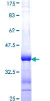 Human UGCG Protein (Recombinant GST, N-terminus)