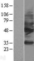 Human SSTR2 Protein (Over-Expression Lysate Myc-DDK (Flag))
