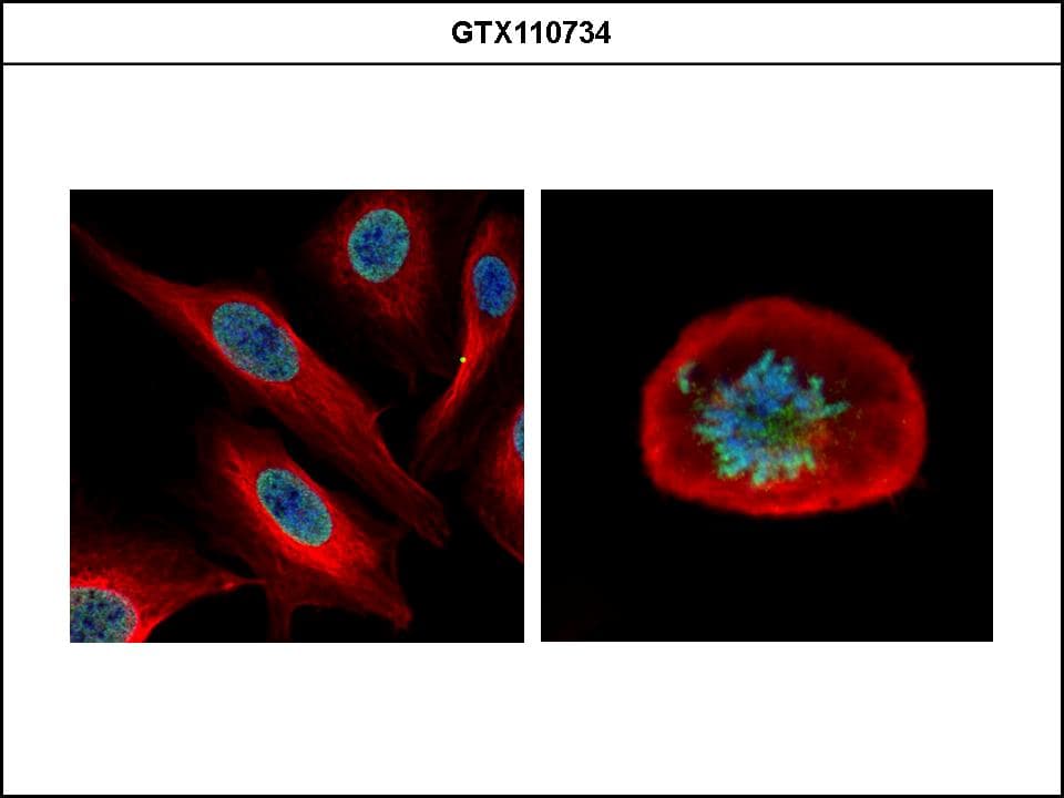 Polyclonal Rabbit anti-Human CDCA1 / NUF2 Antibody (WB)