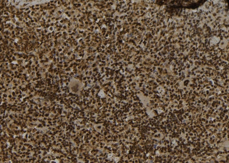 Polyclonal Rabbit anti-Human SECISBP2 / SBP2 Antibody (IHC, WB)