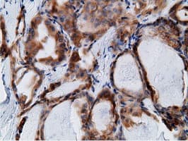 KHK / Ketohexokinase Antibody (clone OTI3D1)