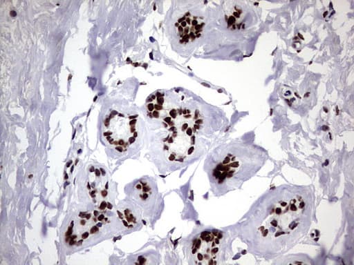 HNRPM / HNRNPM Antibody (aa1-261, clone OTI4C9)