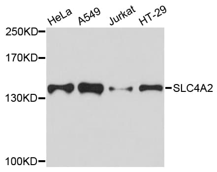Polyclonal Rabbit anti-Human SLC4A2 / AE2 Antibody (WB)