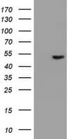 EPHX1 / Epoxide Hydrolase 1 Antibody (aa21-230, clone OTI4G4)