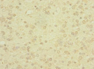 Polyclonal Rabbit anti-Human PCDH19 / Protocadherin 19 Antibody (IHC)