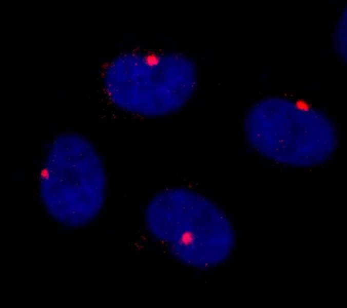 CEP290 Antibody (aa2429-2479)