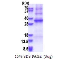 Human ADAL Protein (Recombinant His)