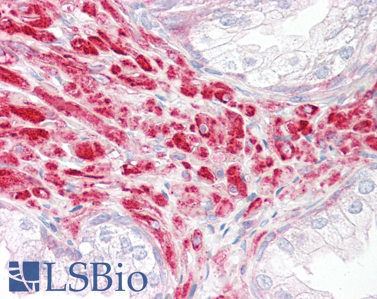 DKK2 Antibody (aa124-173)