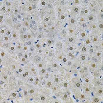 SPHK / SPHK1 Antibody