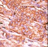 CTDSP2 Antibody (aa12-42)