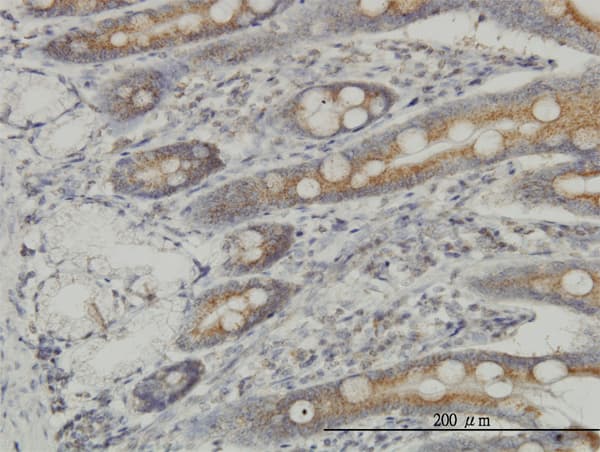 MAP3K4 / MEKK4 Antibody (clone 4F10)
