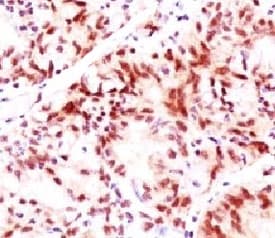 ESR2 / ER Beta Antibody (C-Terminus, clone NR3Gb-1)