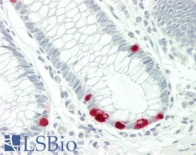 IHC-plus™ Monoclonal Mouse anti-Human ABCC5 / MRP5 Antibody (clone 6C6, IHC, WB)