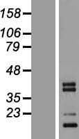 C1QTNF3 / CTRP3 Protein (Over-Expression Lysate Myc-DDK (Flag))