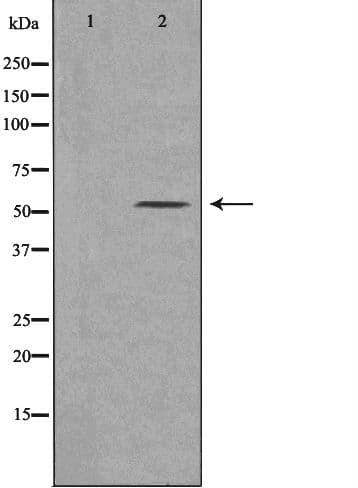 CYP21A2 Antibody