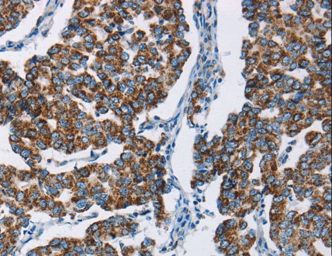 Polyclonal Rabbit anti-Human HINT2 Antibody (IHC, WB)